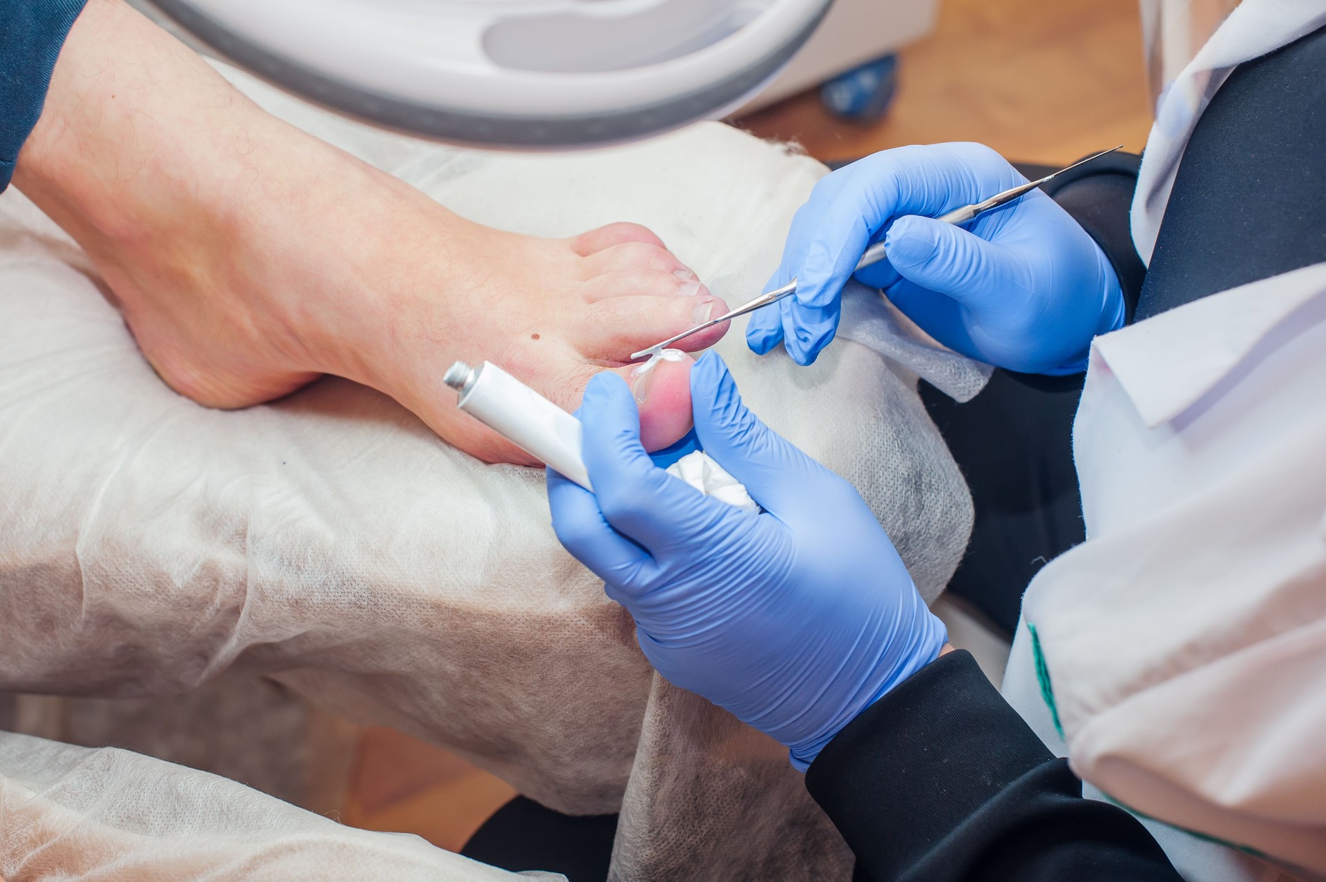 Podology treatment. Podiatrist treating toenail fungus. Doctor removes calluses, corns and treats ingrown nail. Hardware manicure. Health, body care concept. Selective focus